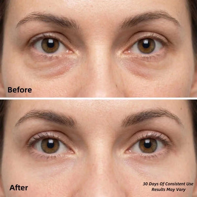 Depuff & Brighten Under Eye Patches